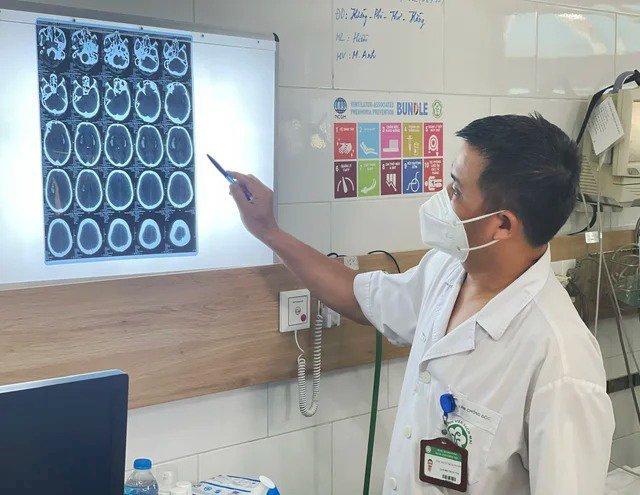 BS Nguyễn Trung Nguyên chỉ rõ hình ảnh tổn thương não của bệnh nhân ngộ độc methanol. Ảnh: BV Bạch Mai