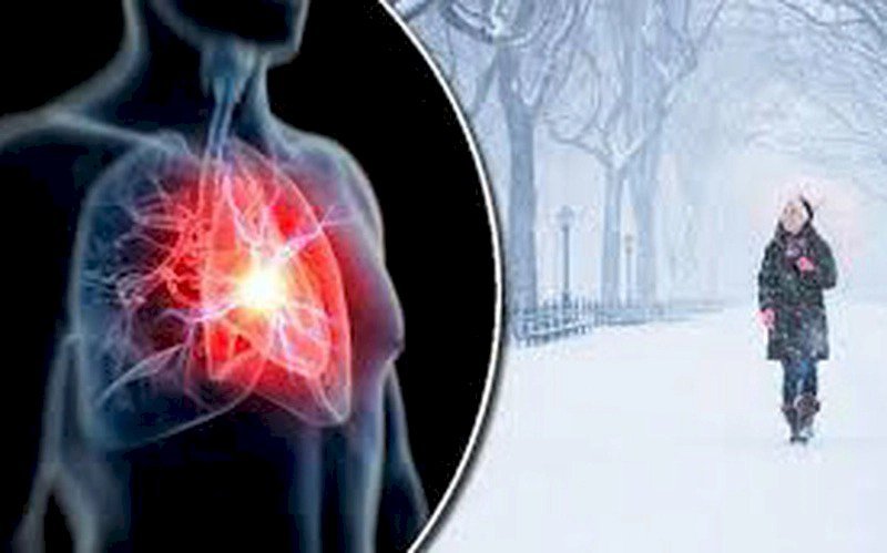 Bệnh đột quỵ gia tăng khi trời lạnh - dấu hiệu nhận biết và thời gian vàng điều trị