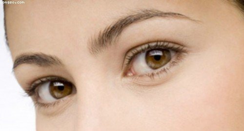 Mắt thâm quầng: Nguyên nhân và cách chữa trị